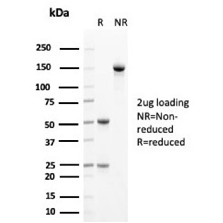 SDS-PAGE - Anti-Cytokeratin 14 Antibody [KRT14/4125] (A277686) - Antibodies.com