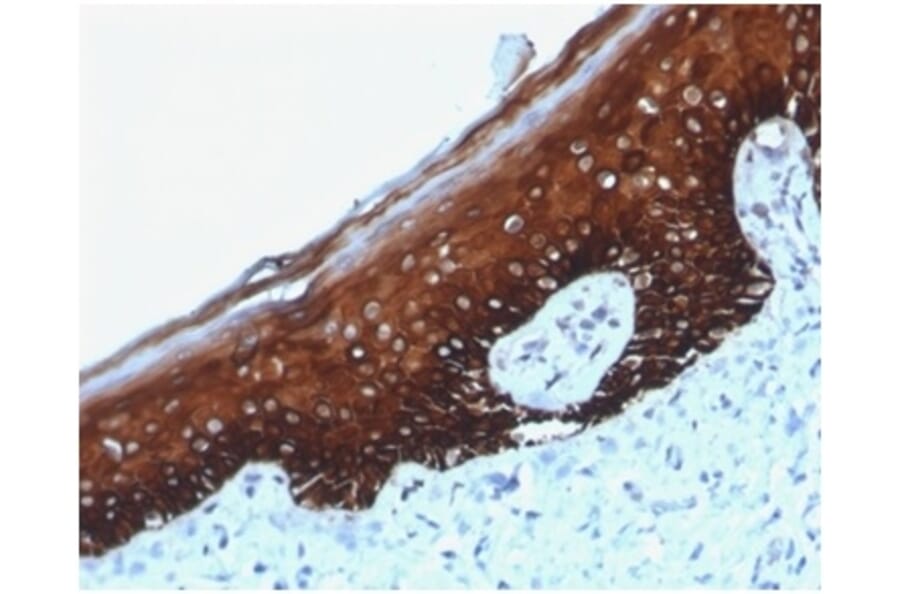 Immunohistochemistry - Anti-Cytokeratin 14 Antibody [KRT14/4125] (A277686) - Antibodies.com