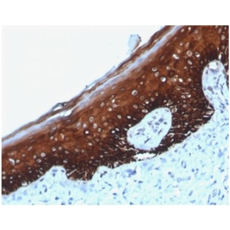 Immunohistochemistry - Anti-Cytokeratin 14 Antibody [KRT14/4125] (A277686) - Antibodies.com