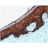 Immunohistochemistry - Anti-Cytokeratin 14 Antibody [KRT14/4125] (A277686) - Antibodies.com