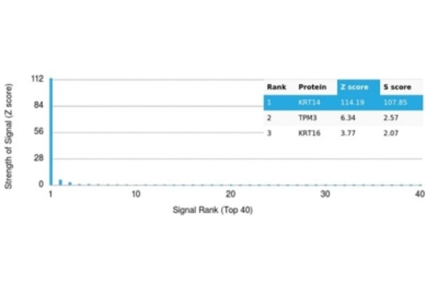 Protein Array - Anti-Cytokeratin 14 Antibody [KRT14/4125] (A277686) - Antibodies.com