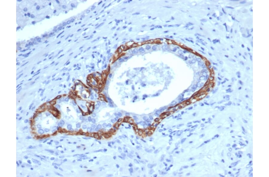 Immunohistochemistry - Anti-Cytokeratin 14 Antibody [KRT14/4129] (A277687) - Antibodies.com