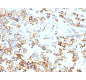 Immunohistochemistry - Anti-Cytokeratin 17 Antibody [KRT17/4604] (A277688) - Antibodies.com