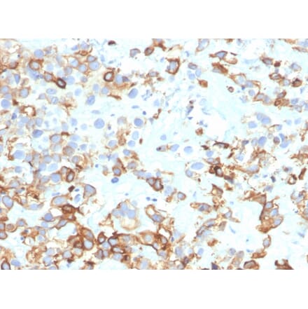 Immunohistochemistry - Anti-Cytokeratin 17 Antibody [KRT17/4604] (A277688) - Antibodies.com