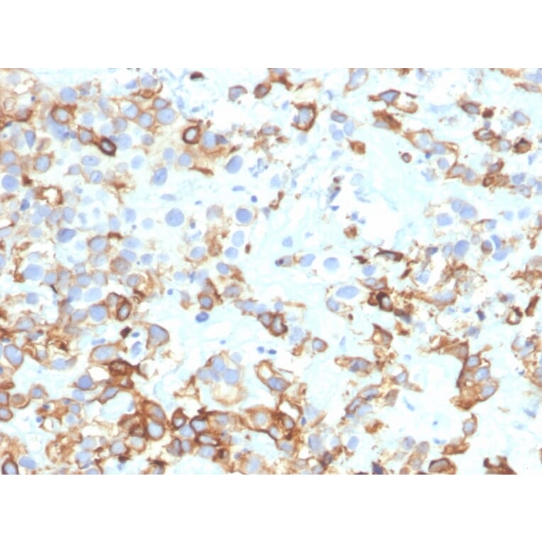 Immunohistochemistry - Anti-Cytokeratin 17 Antibody [KRT17/4604] (A277688) - Antibodies.com