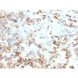 Immunohistochemistry - Anti-Cytokeratin 17 Antibody [KRT17/4604] (A277688) - Antibodies.com