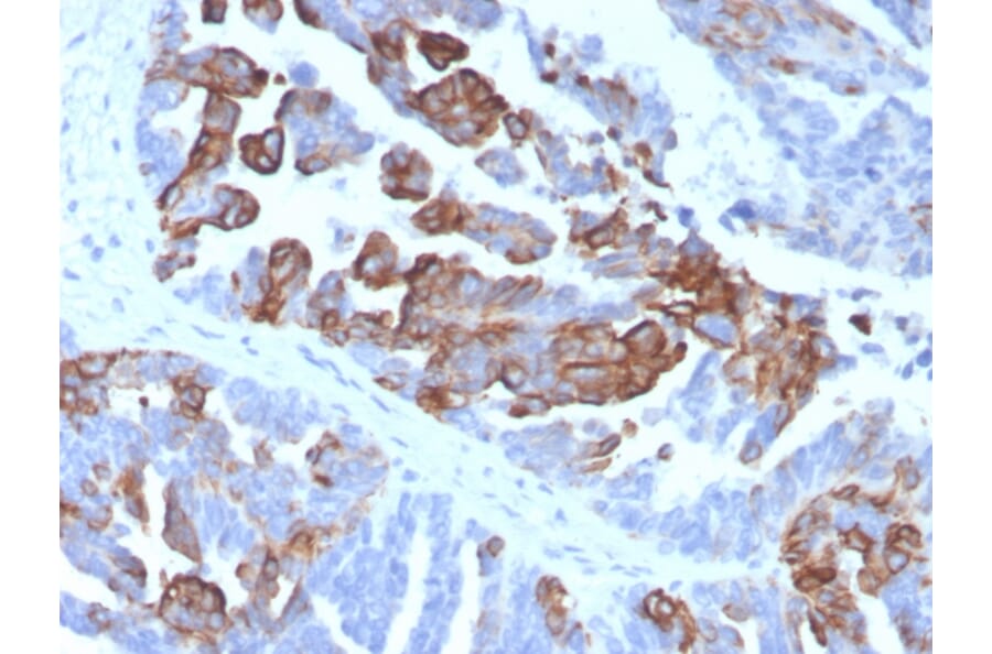 Immunohistochemistry - Anti-Cytokeratin 17 Antibody [KRT17/4604] (A277688) - Antibodies.com