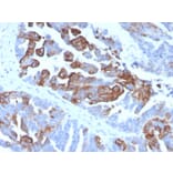 Immunohistochemistry - Anti-Cytokeratin 17 Antibody [KRT17/4604] (A277688) - Antibodies.com