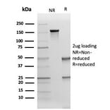 SDS-PAGE - Anti-Cytokeratin 17 Antibody [KRT17/4604] (A277688) - Antibodies.com
