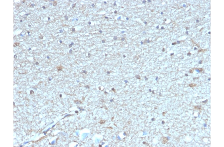 Immunohistochemistry - Anti-Leptin Receptor Antibody [LEPR/4304] (A277690) - Antibodies.com