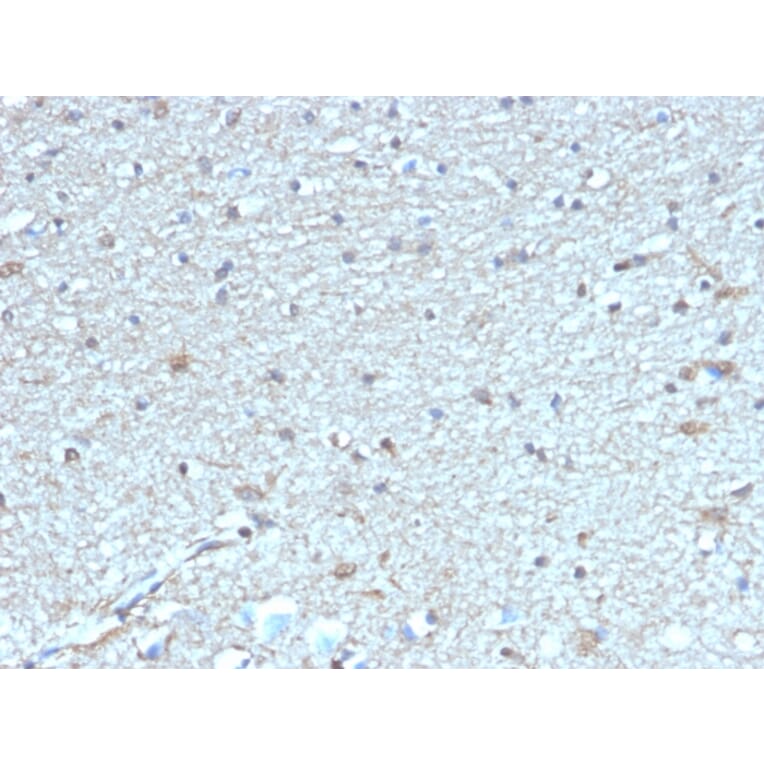 Immunohistochemistry - Anti-Leptin Receptor Antibody [LEPR/4304] (A277690) - Antibodies.com