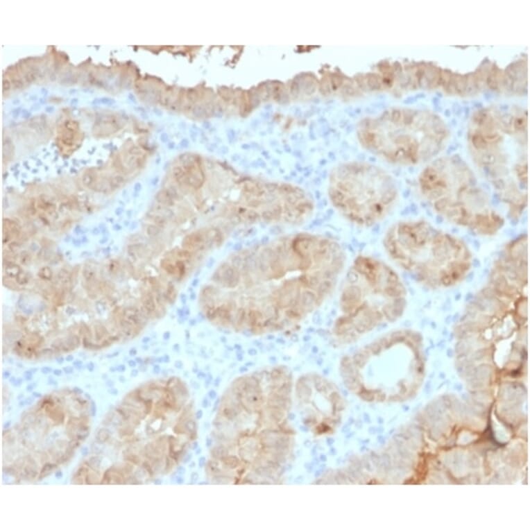 Immunohistochemistry - Anti-Galectin 3 Antibody [LGALS3/4792] (A277691) - Antibodies.com