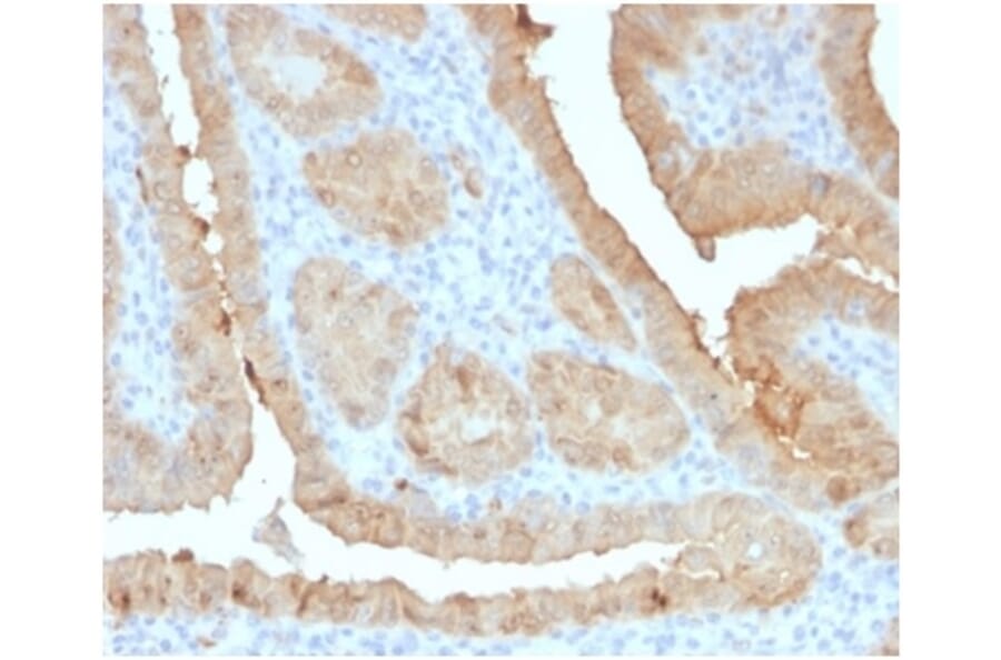 Immunohistochemistry - Anti-Galectin 3 Antibody [LGALS3/4792] (A277691) - Antibodies.com