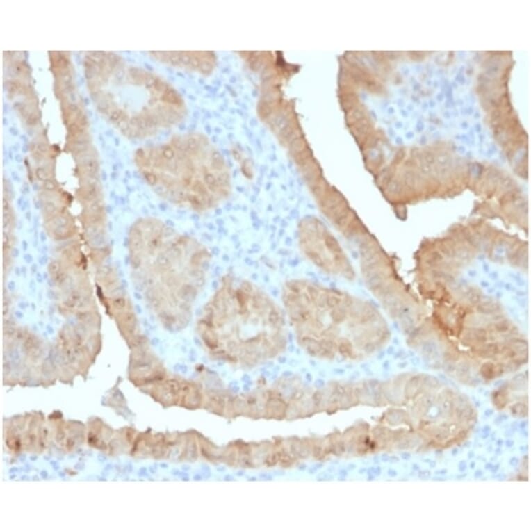 Immunohistochemistry - Anti-Galectin 3 Antibody [LGALS3/4792] (A277691) - Antibodies.com