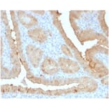 Immunohistochemistry - Anti-Galectin 3 Antibody [LGALS3/4792] (A277691) - Antibodies.com