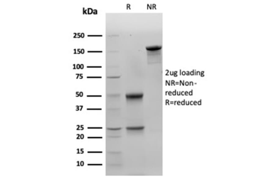 SDS-PAGE - Anti-Galectin 3 Antibody [LGALS3/4792] (A277691) - Antibodies.com