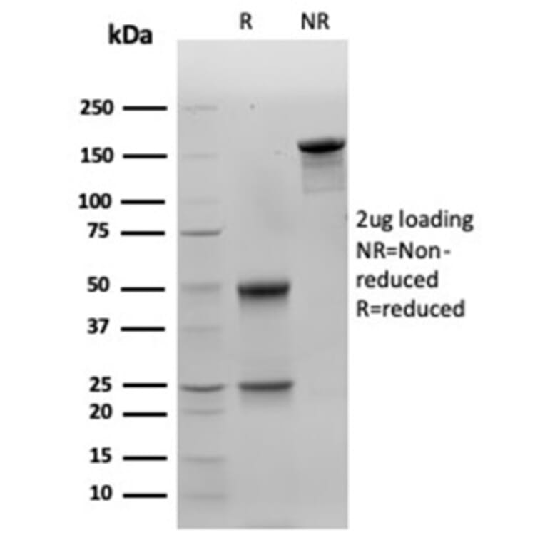 SDS-PAGE - Anti-Galectin 3 Antibody [LGALS3/4792] (A277691) - Antibodies.com