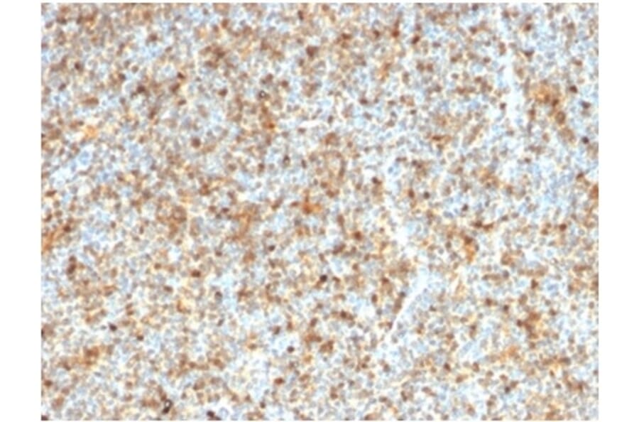 Immunohistochemistry - Anti-LMO2 Antibody [LMO2/1972] (A277692) - Antibodies.com