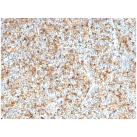 Immunohistochemistry - Anti-LMO2 Antibody [LMO2/1972] (A277692) - Antibodies.com