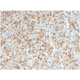 Immunohistochemistry - Anti-LMO2 Antibody [LMO2/1972] (A277692) - Antibodies.com