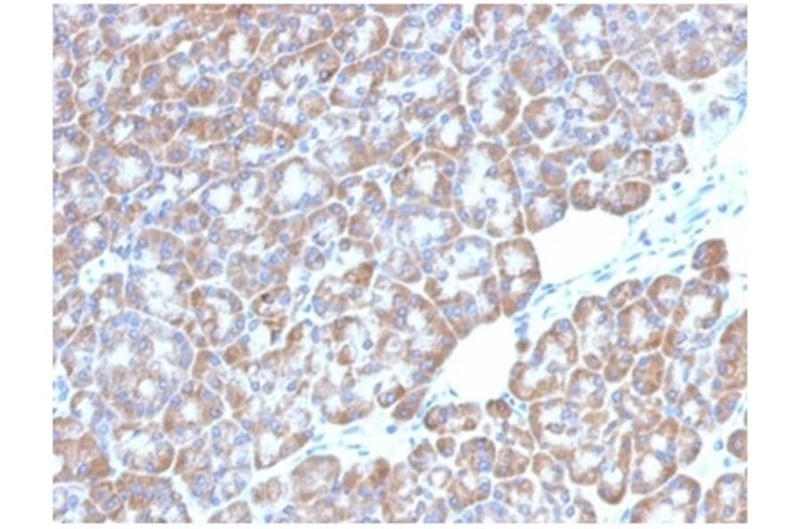 Immunohistochemistry - Anti-LMO2 Antibody [LMO2/1972] (A277692) - Antibodies.com