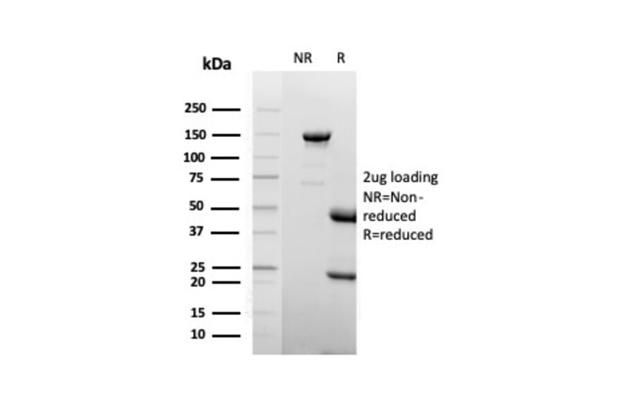 SDS-PAGE - Anti-Lactoferrin Antibody [LTF/4075] (A277695) - Antibodies.com