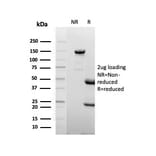 SDS-PAGE - Anti-Lactoferrin Antibody [LTF/4075] (A277695) - Antibodies.com