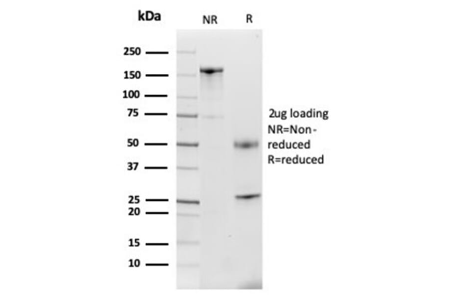SDS-PAGE - Anti-Lactoferrin Antibody [LTF/4079] (A277696) - Antibodies.com
