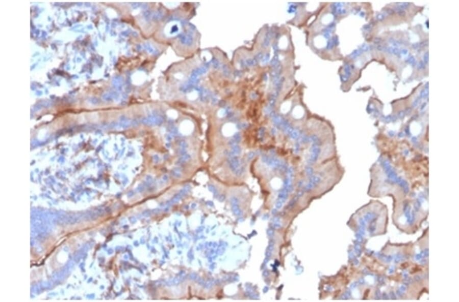 Immunohistochemistry - Anti-LY75 Antibody [CD205/3720] (A277697) - Antibodies.com