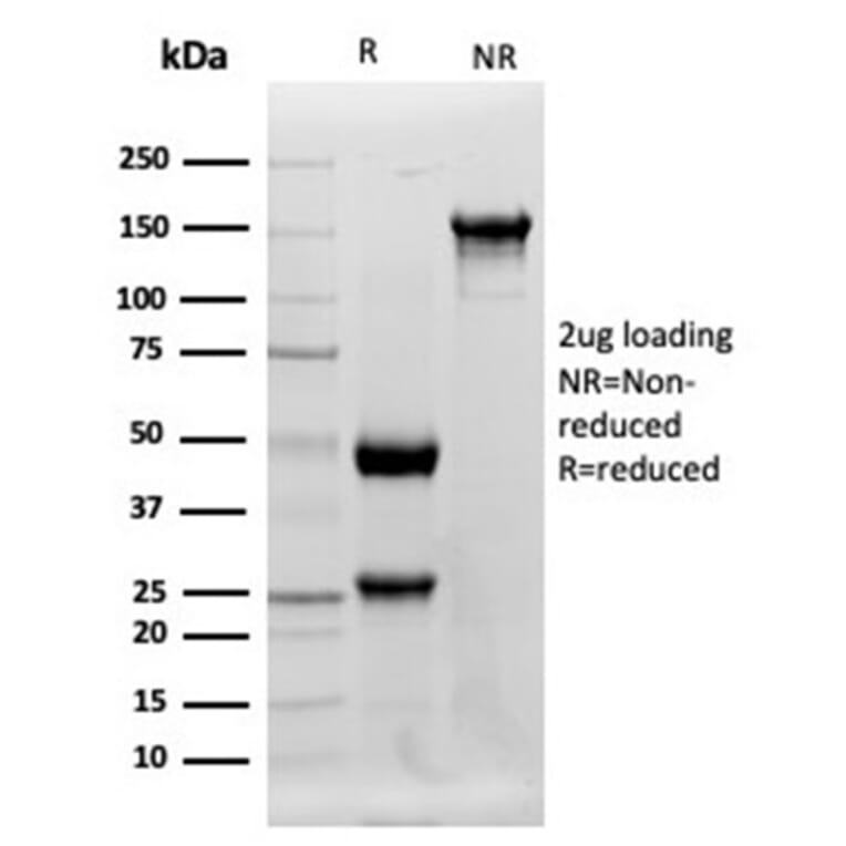 Western Blot - Anti-Lysozyme Antibody [LYZ/3942] (A277699) - Antibodies.com