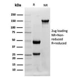Western Blot - Anti-Lysozyme Antibody [LYZ/3942] (A277699) - Antibodies.com
