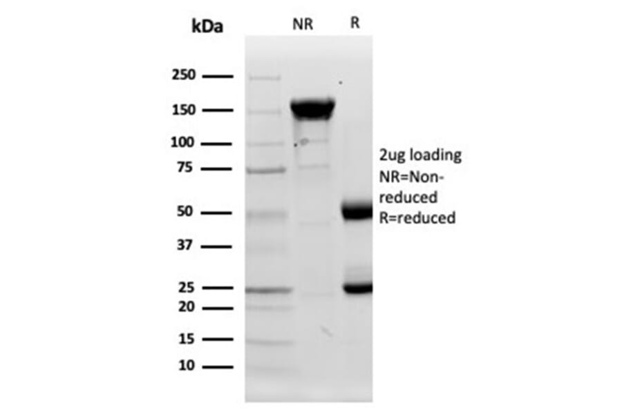 Protein Array - Anti-Lysozyme Antibody [LYZ/3944] (A277701) - Antibodies.com