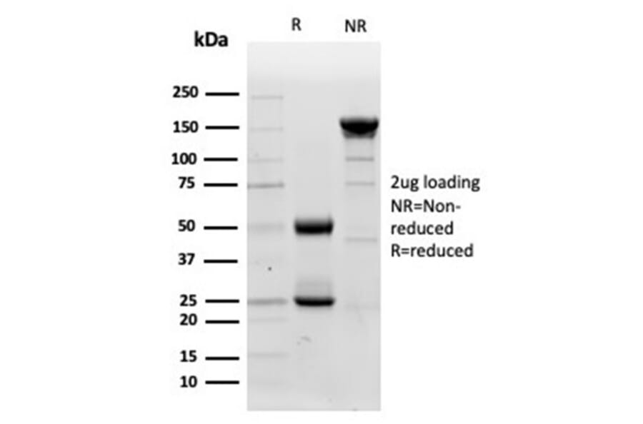 SDS-PAGE - Anti-Lysozyme Antibody [LYZ/3947] (A277702) - Antibodies.com