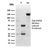 SDS-PAGE - Anti-Lysozyme Antibody [LYZ/3947] (A277702) - Antibodies.com