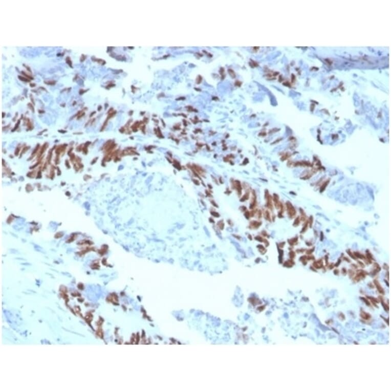 Immunohistochemistry - Anti-MCM2 Antibody [MCM2/3678] (A277703) - Antibodies.com