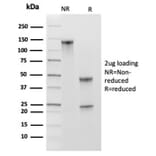 SDS-PAGE - Anti-MCM2 Antibody [MCM2/3678] (A277703) - Antibodies.com