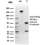 SDS-PAGE - Anti-MEF2D Antibody [PCRP-MEF2D-3A4] (A277705) - Antibodies.com