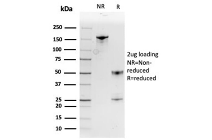 SDS-PAGE - Anti-MIF Antibody [MIF/3488] (A277706) - Antibodies.com
