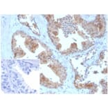 Immunohistochemistry - Anti-MIF Antibody [MIF/3490] (A277708) - Antibodies.com