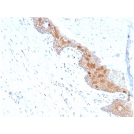 Immunohistochemistry - Anti-MIF Antibody [MIF/4336] (A277709) - Antibodies.com