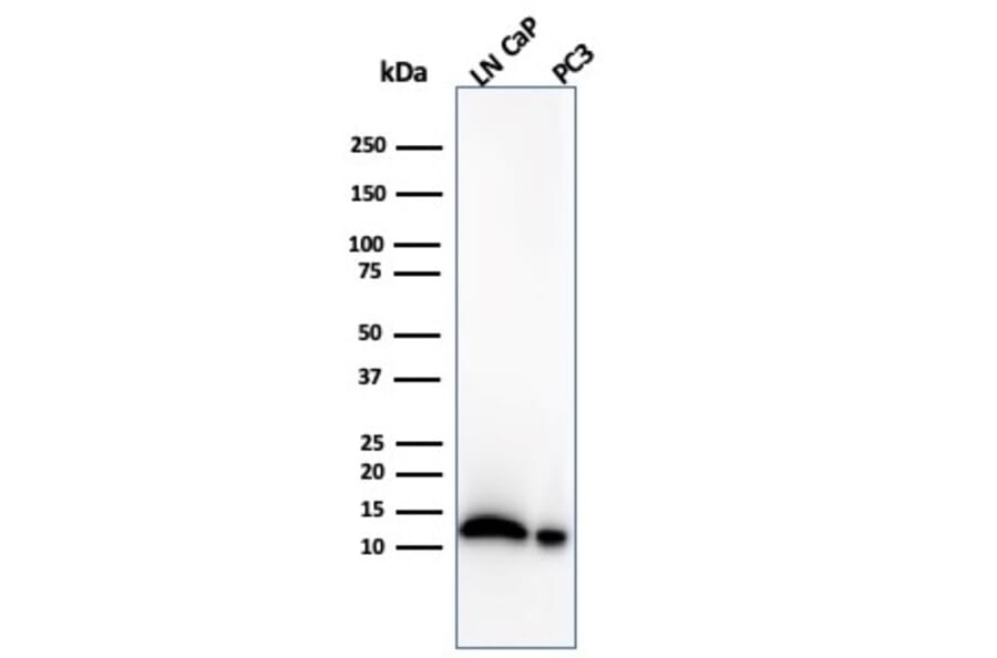 Western Blot - Anti-MIF Antibody [MIF/4336] (A277709) - Antibodies.com