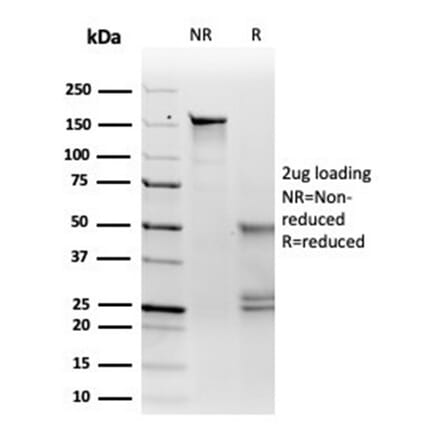 SDS-PAGE - Anti-MiTF Antibody [PCRP-MITF-1D9] (A277710) - Antibodies.com