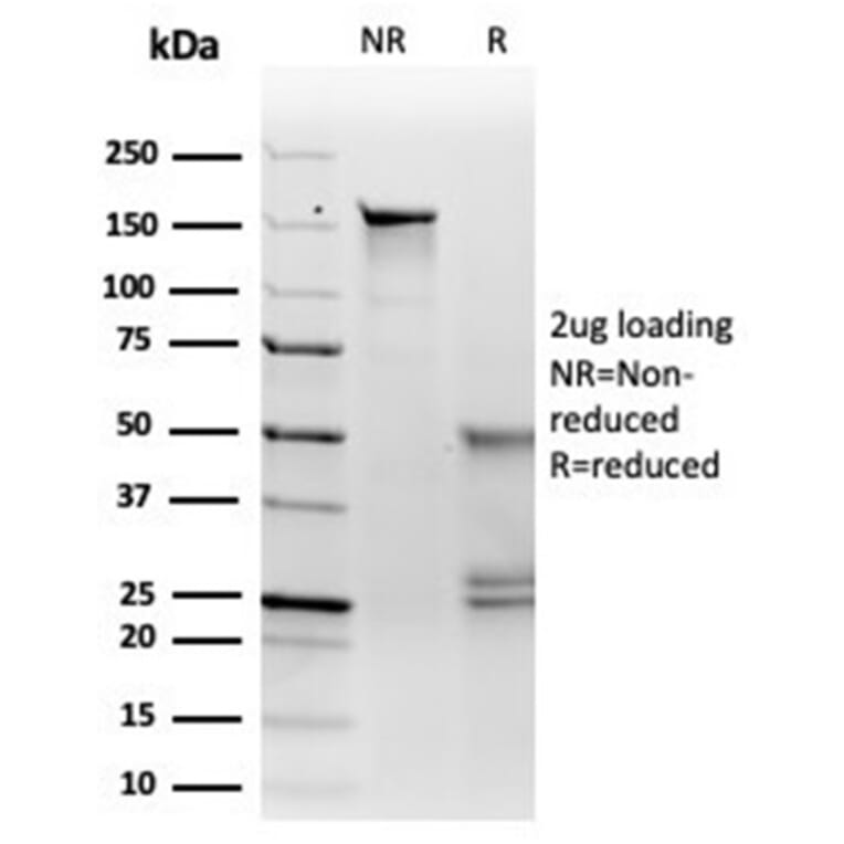 SDS-PAGE - Anti-MiTF Antibody [PCRP-MITF-1D9] (A277710) - Antibodies.com