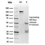 SDS-PAGE - Anti-MiTF Antibody [PCRP-MITF-1D9] (A277710) - Antibodies.com