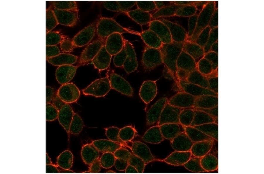 Immunofluorescence - Anti-MiTF Antibody [PCRP-MITF-1D9] (A277710) - Antibodies.com