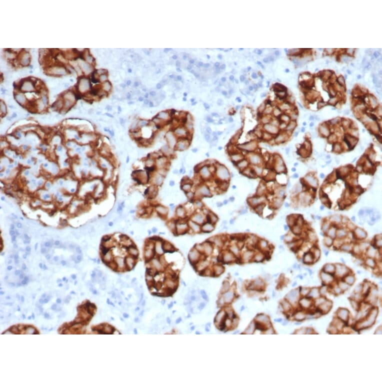 Immunohistochemistry - Anti-CD10 Antibody [MME/6461] (A277712) - Antibodies.com