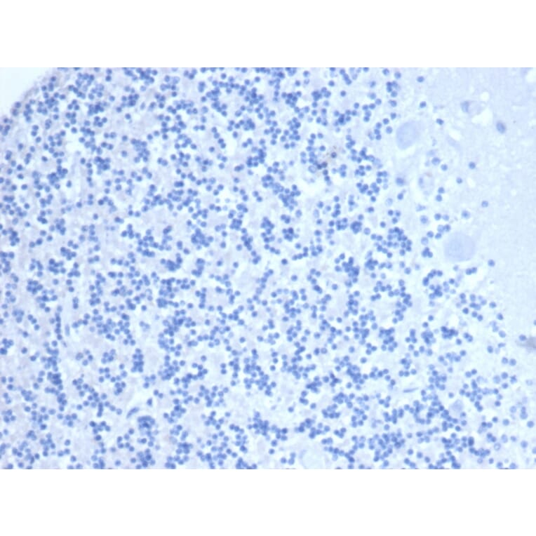 Immunohistochemistry - Anti-CD10 Antibody [MME/6461] (A277712) - Antibodies.com