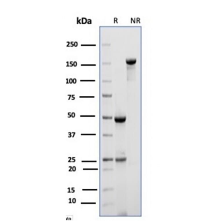 SDS-PAGE - Anti-CD10 Antibody [MME/6714] (A277713) - Antibodies.com