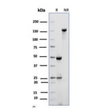 SDS-PAGE - Anti-CD10 Antibody [MME/6714] (A277713) - Antibodies.com