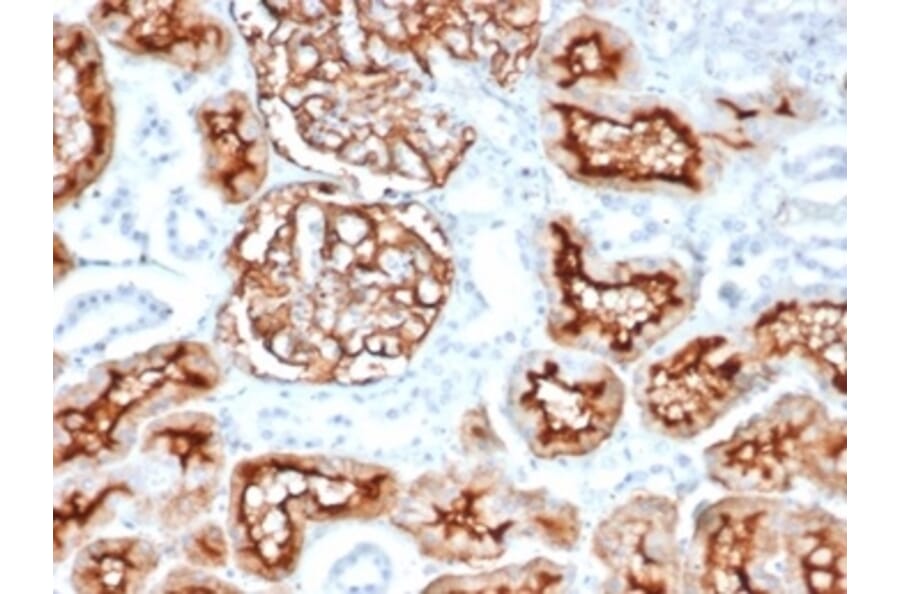 Immunohistochemistry - Anti-CD10 Antibody [MME/6714] (A277713) - Antibodies.com